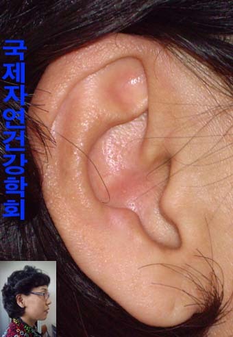송*희 이미지