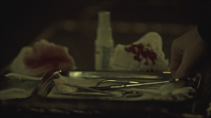 [로맨틱스릴러미드] 한니발 (Hannibal) 시즌3 에피6 (1/4) | 인스티즈