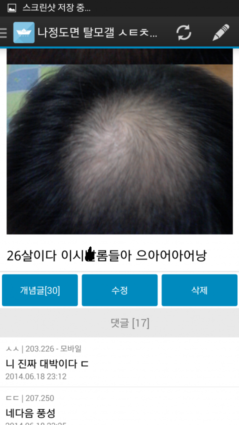 탈모갤 26살.JPG | 인스티즈