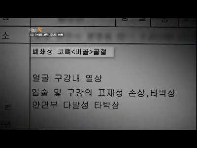 8살 딸이 맞았다고 보복폭행한 아버지. 제발 읽고 오해좀 풀었으면 ㅠㅠ 남자애가 맞을짓 한거 아님 | 인스티즈