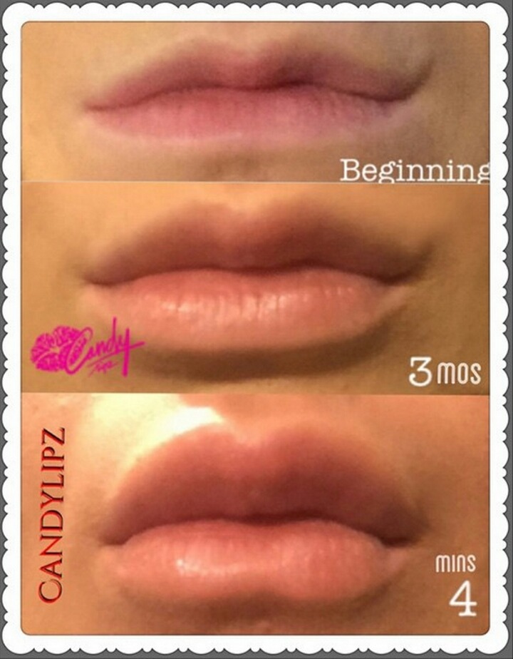 서양권에서 많이하는 성형수술 세개 | 인스티즈