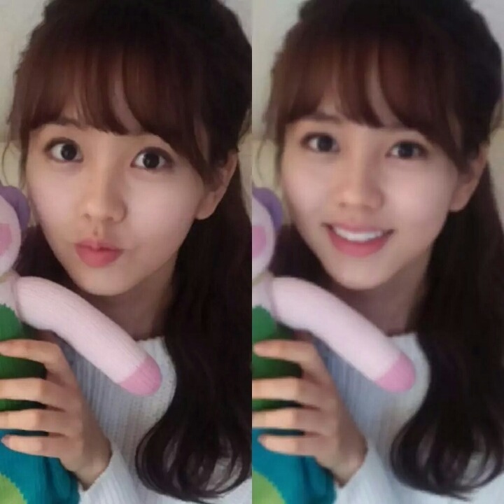 쏘 이미지