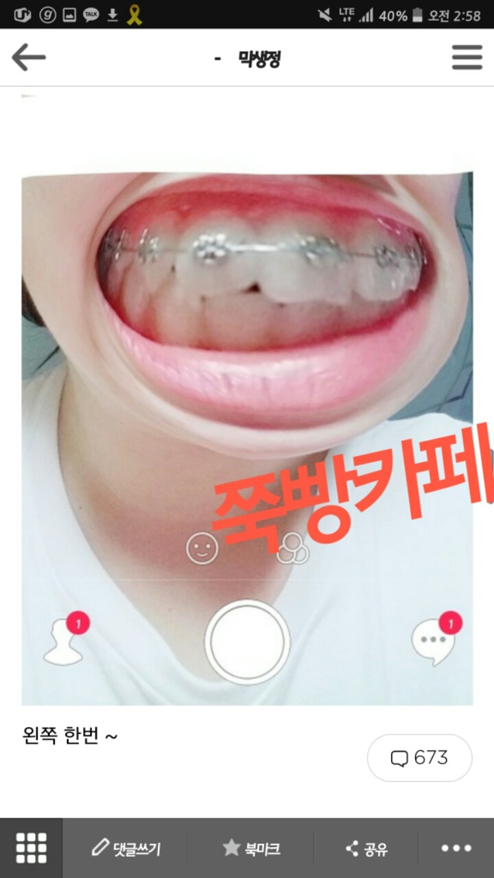 막생정에 올라온 치아에 낀 음식 확인할때 (배꼽주의) | 인스티즈