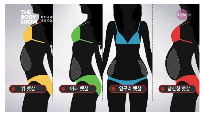 여자들의 뱃살 유형 | 인스티즈