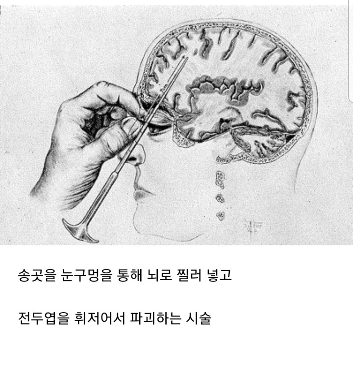 현대에 태어난걸 감사해야 하는 이유 | 인스티즈