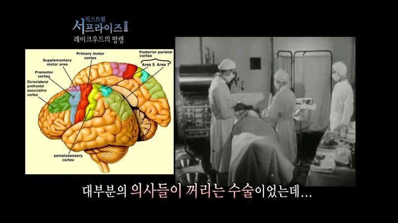 [서프라이즈] 잘못된 수술 레이크우드의 망령.jpg | 인스티즈