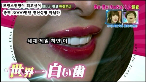프랑스 인형이 되고싶어 총액 3000만엔 전신성형한 바닐라 | 인스티즈