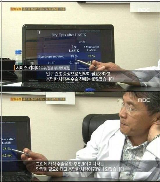 라식 라섹수술을 하면 안되는 이유....jpg | 인스티즈