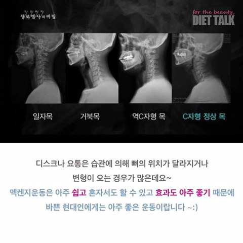 거북목 허리디스크 요통에 좋은 운동 | 인스티즈