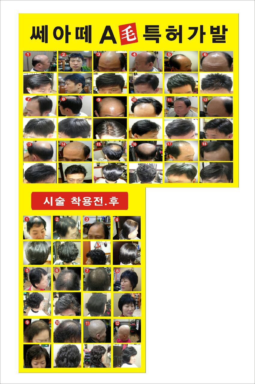 에이모가발 이미지